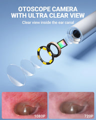 ScopeAround caméra oreille avec lumière LED pour un diagnostic précis