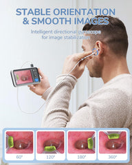 ScopeAround gyroscope – stabilisation d'image pour des vues nettes