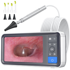 ScopeAround otoscope avec écran IPS – visualisation claire lors d’un examen