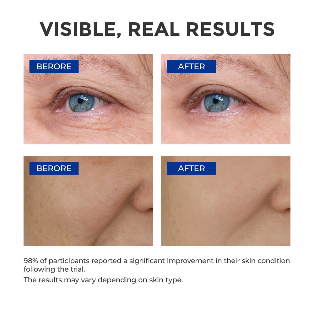 Aplicación de absorcion rápida del serum SKINERSE durante la noche.
