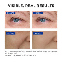 Aplicación de absorcion rápida del serum SKINERSE durante la noche.