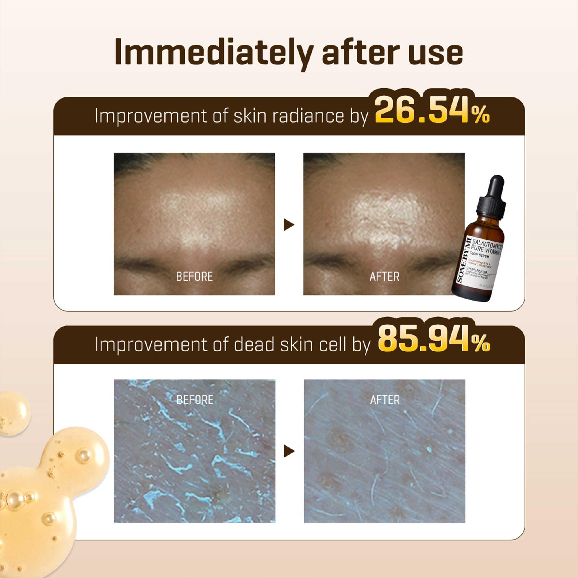 Prueba de irritación en piel, serum Some By Mi es apto para piel sensible.