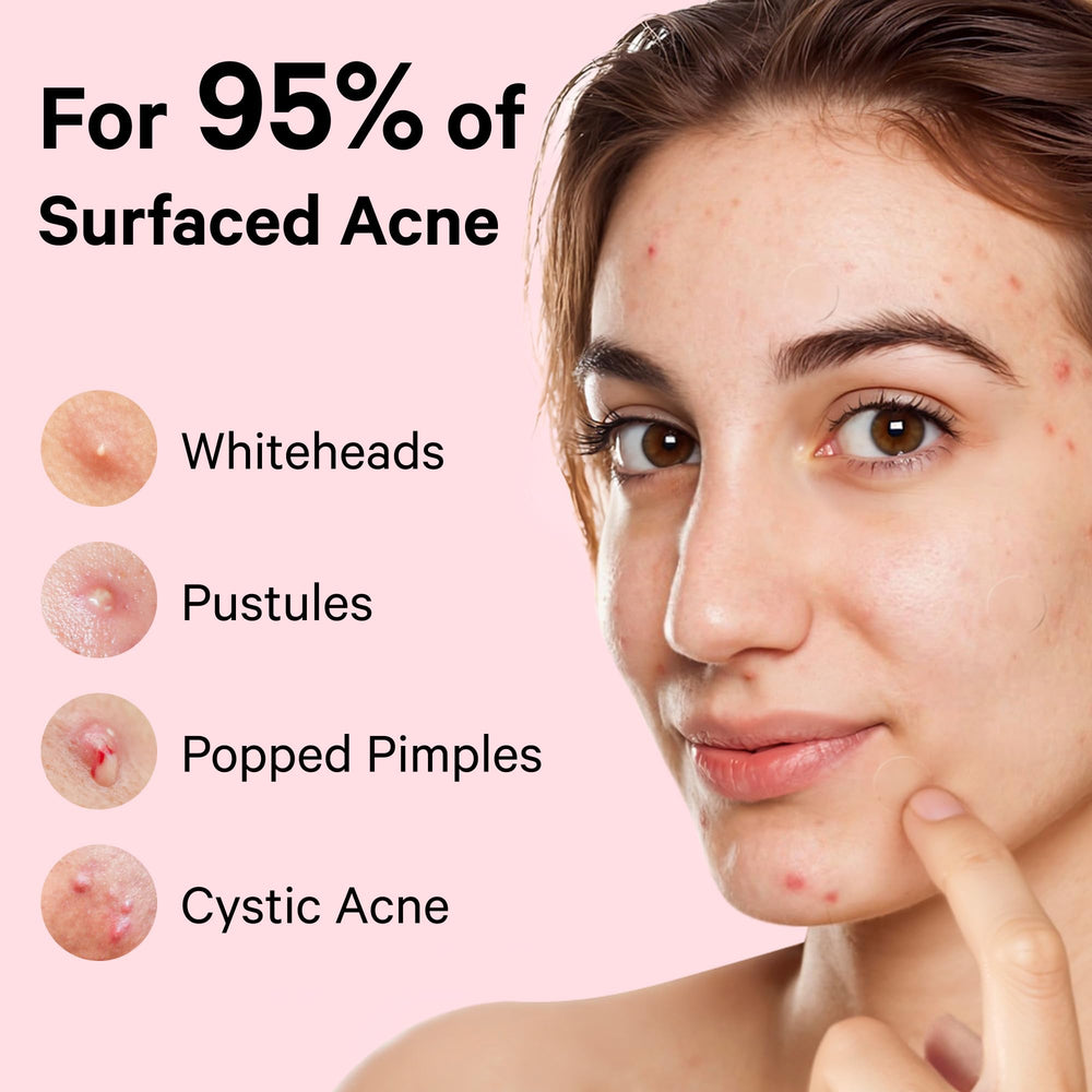 FSA/HSA eligible Sosky patches label for budget-friendly skincare