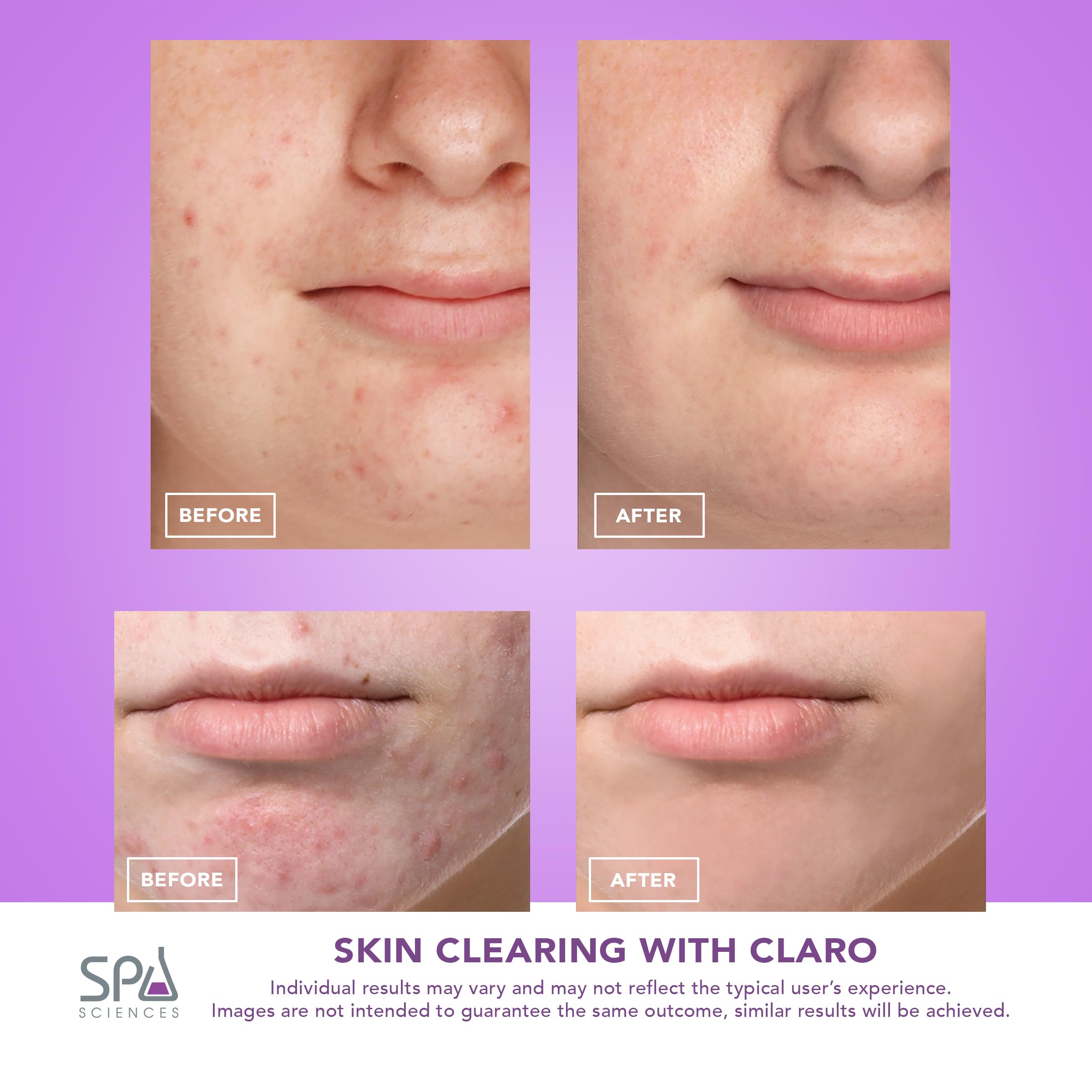 Spa Sciences CLARO: indicador de batería para saber cuándo recargar.