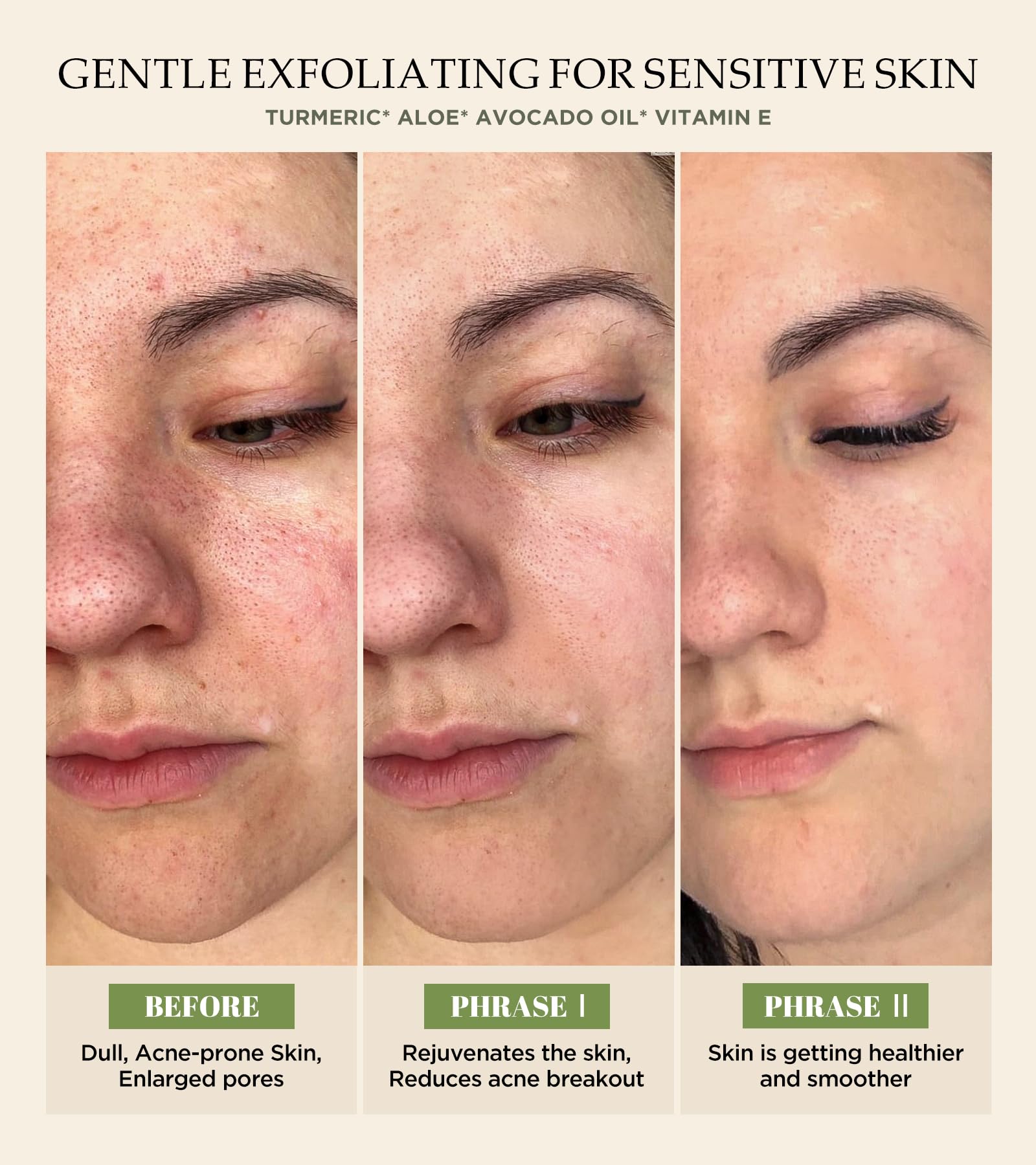 Srripo exfoliante facial, aplicación suave para uso cómodo