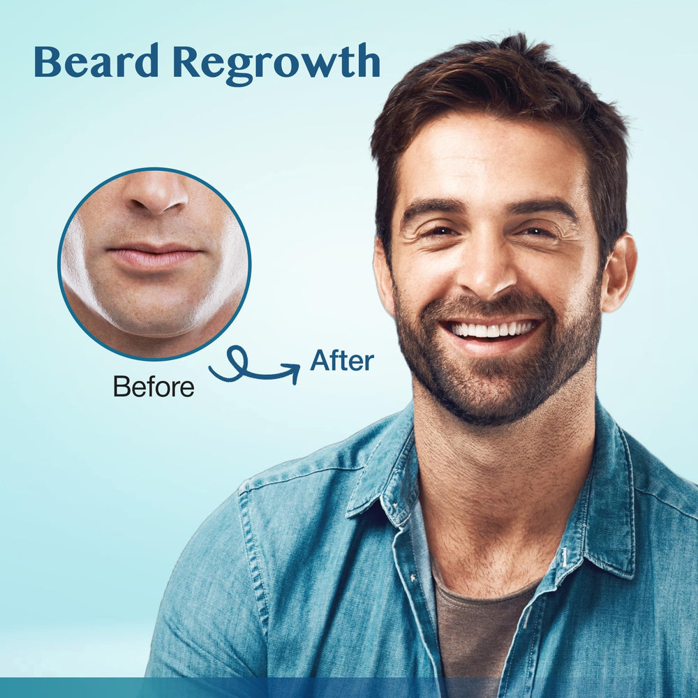 Zone barbe en régénération ciblée avec Stafenit Minoxidil.