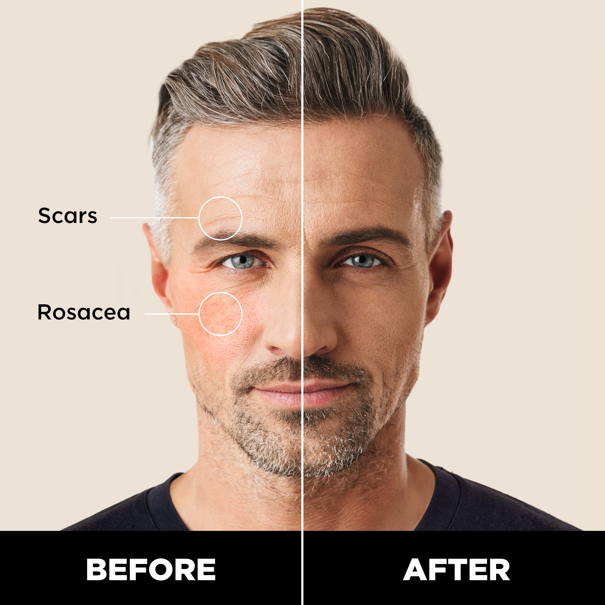 Dab and blend action on the face with Stryx Concealer Tool