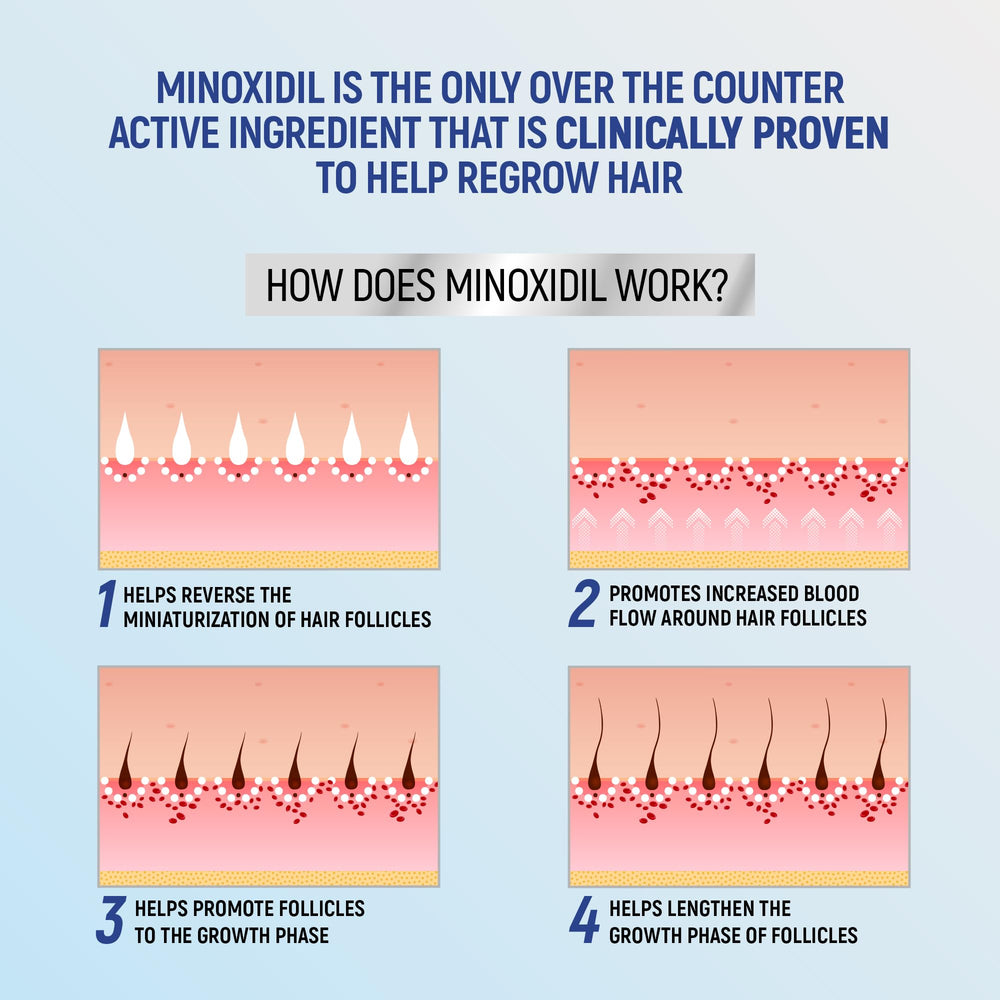 TARO Minoxidil regeneración de cabello: enfoque consistente para resultados posibles.