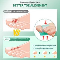 TASZOOS Corrector de dedo martillo en gel verde, talla mediana para pies.
