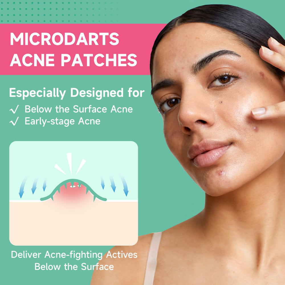 TEAWOO 36-count patch pack arranged for easy on-the-go acne care