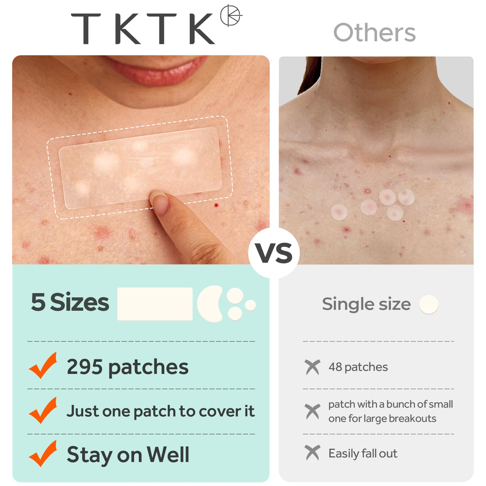 Parche TKTK para acne en la espalda, fija bien sin irritar la piel.