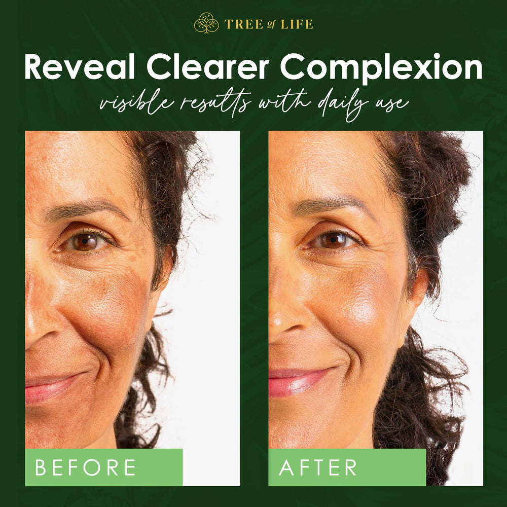 Piel sensible se beneficia con fórmula suave de Tree of Life Beauty.