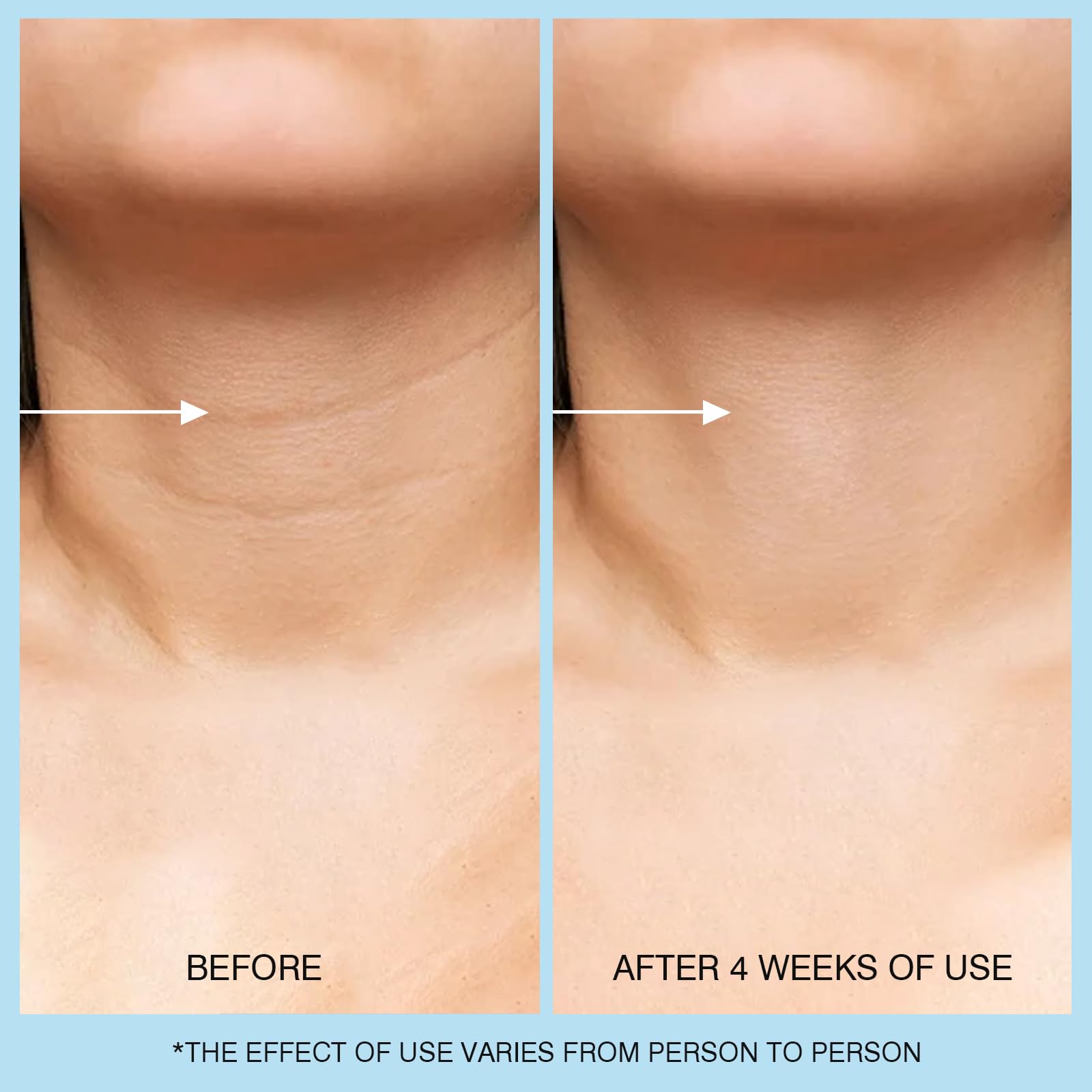 UJhay crema cuello hialuronico vitamina C, hidratación y luminosidad