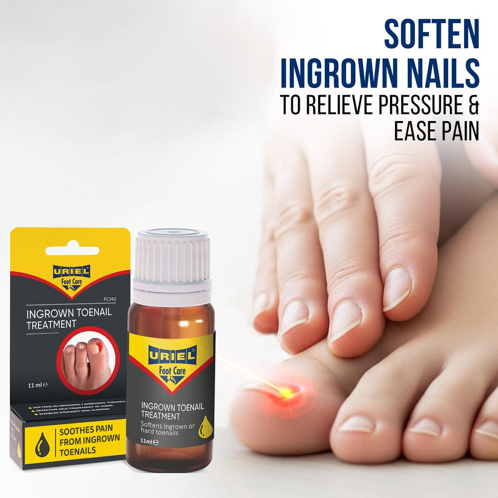 URIEL Correcteur Ongle Incarné: utilisation ciblée pour un alignement plus confortable.