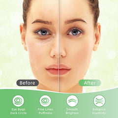 USTELIR patches being applied under the eyes for quick rejuvenation.