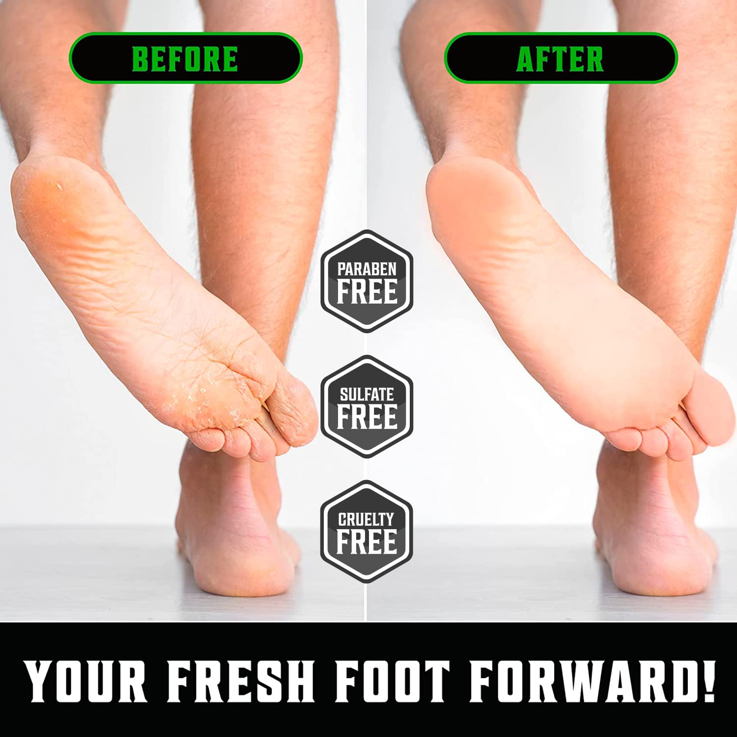 Viking Revolution Tea Tree Oil foot cream provides cooling relief.