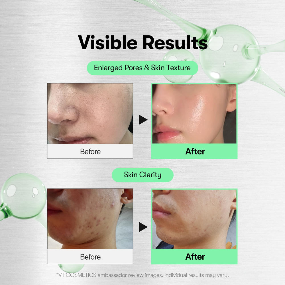 VT COSMETICS CICA Reedle Shot 700: aplicación en piel limpia para renovación suave.
