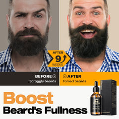 Aroma suave del aceite de barba Waking Forest con sándalo