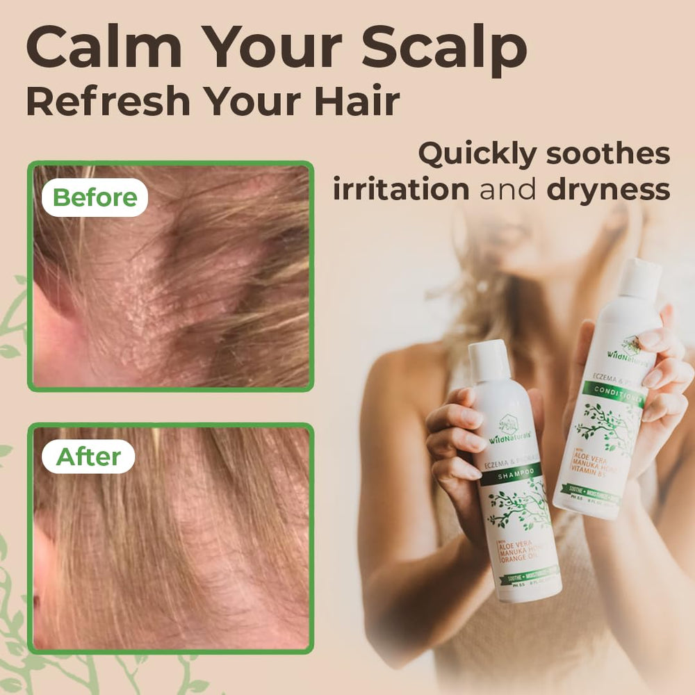 Base de aloe vera en Wild Naturals, frasco, textura ligera.