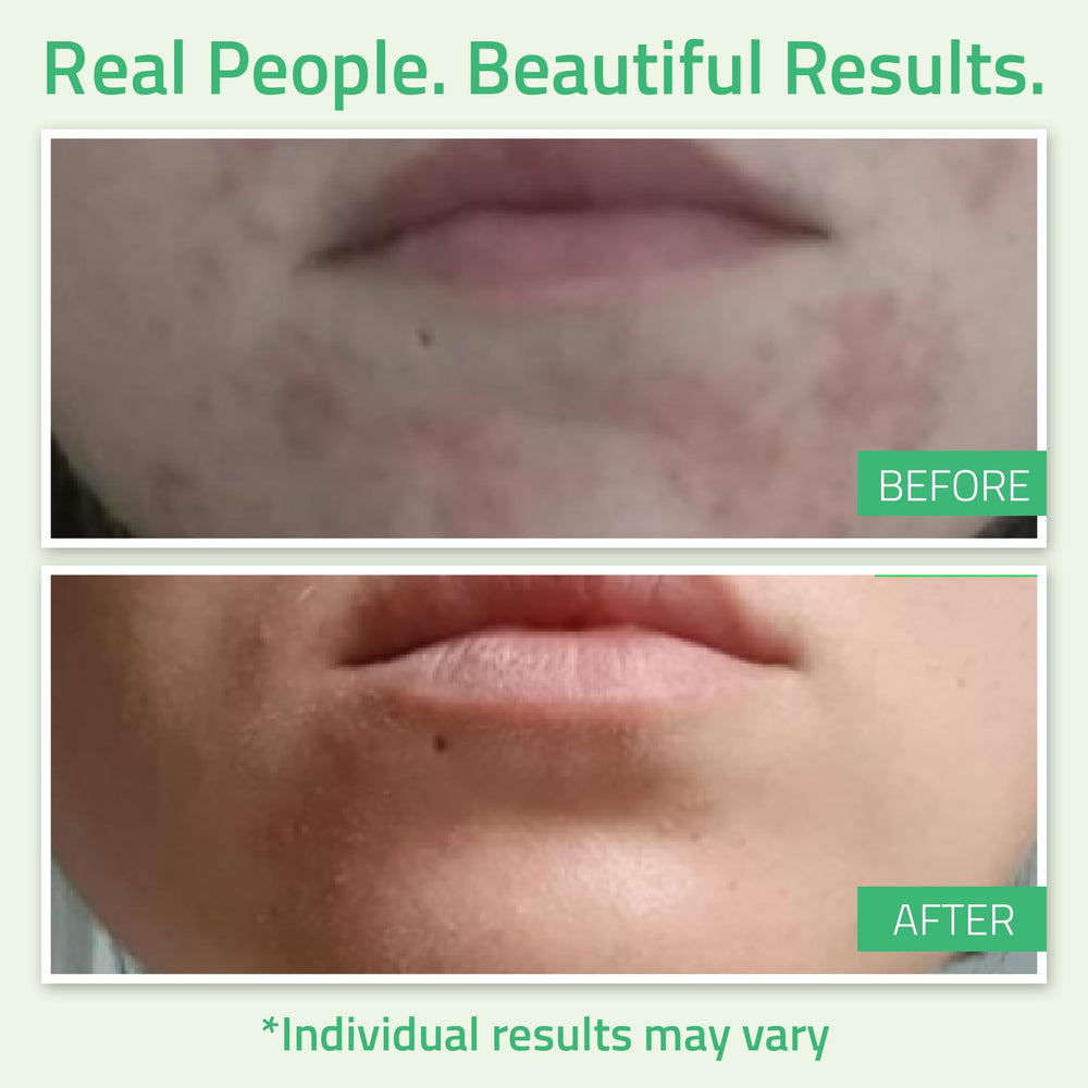 yeouth te verde retinol ingredientes destacados para piel mas clara