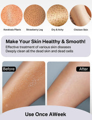 Gants exfoliants Yiclick pores plus nets après utilisation