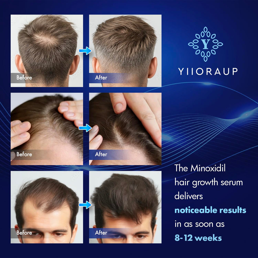 YIIORAUP Biotin-enhanced formula label signaling scalp care benefits
