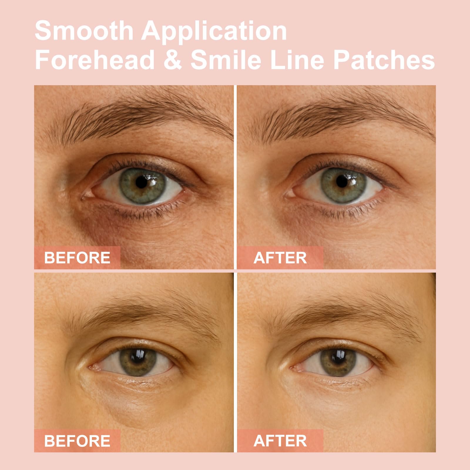 Aplicación de parches oculares para cuidado suave y cómodo
