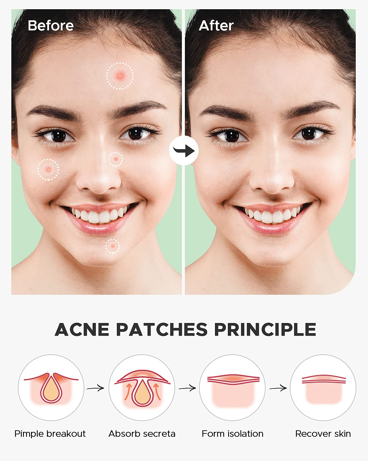 ZATKTK patch applied overnight for discreet coverage