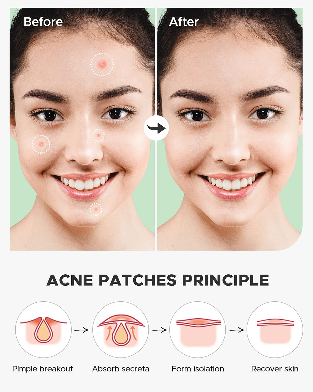 ZATKTK patch applied overnight for discreet coverage