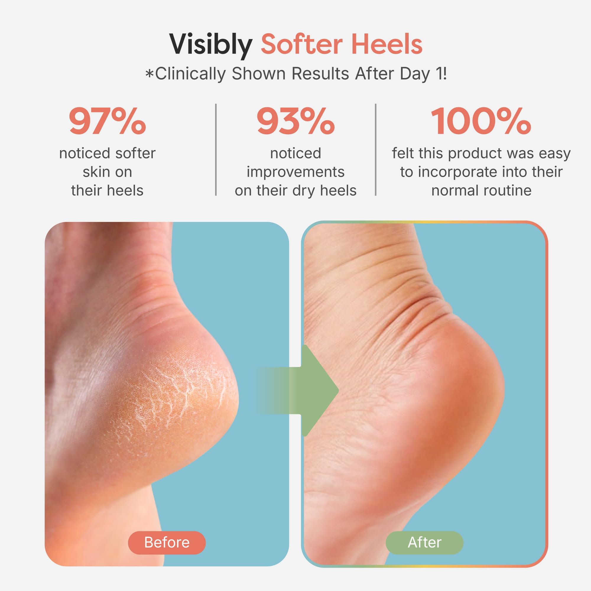 Aceites oliva y jojoba con vitamina E en ZenToes.